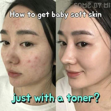 SOME BY MI AHA, BHA, PHA 30 Days Miracle Toner 150ml